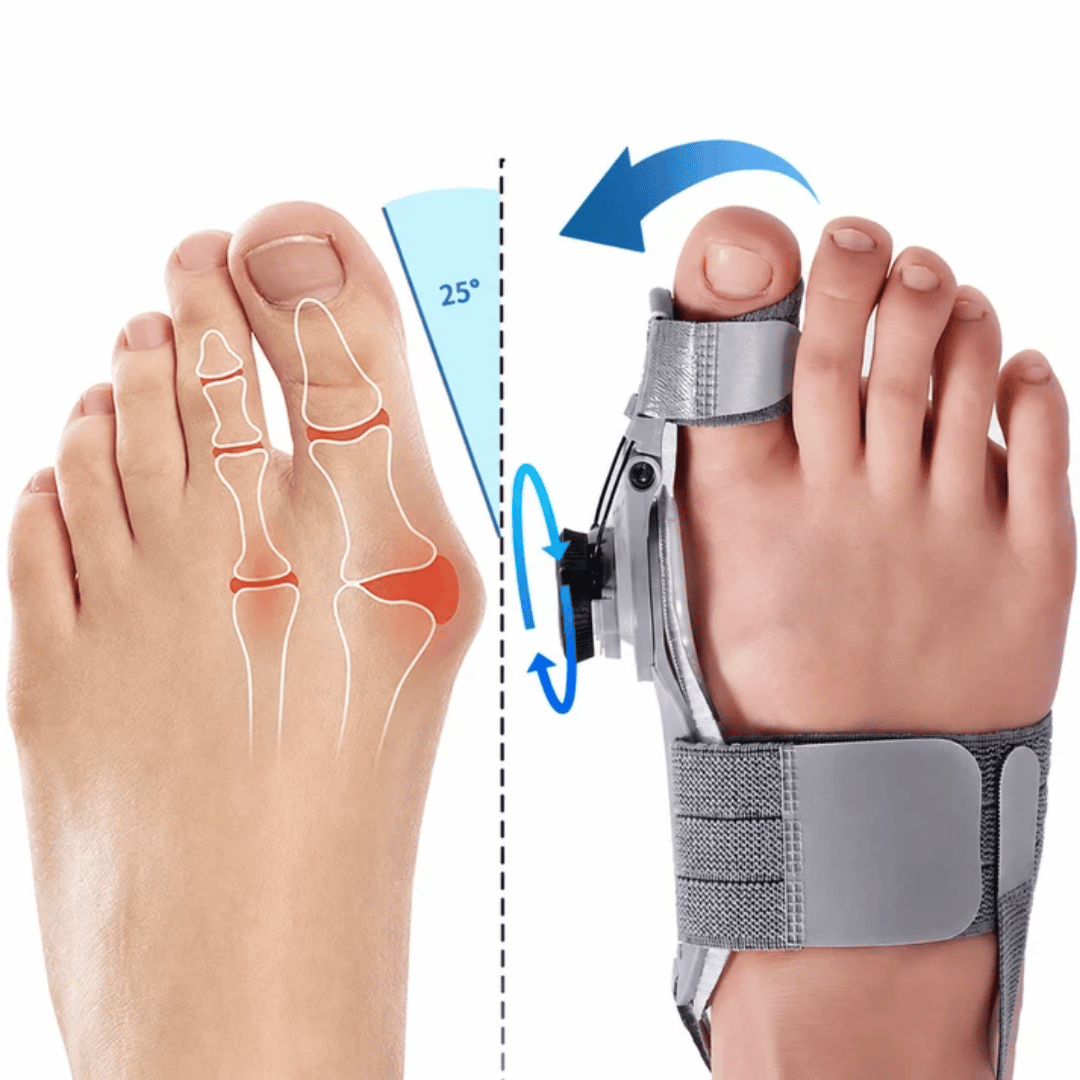Vitessa Hallux Valgus Pro