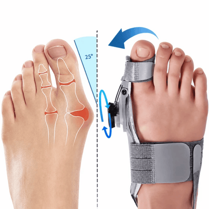 Vitessa Hallux Valgus Pro